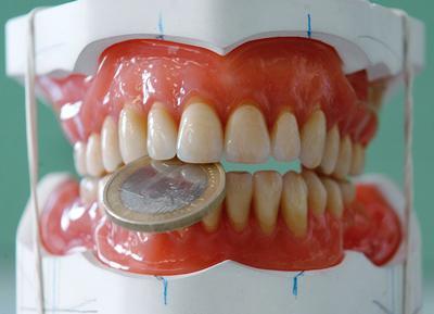 Zahnersatz vom Zahnarzt gnstig in Tschechien